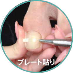 アクリル素材を使い、爪を覆っていきます。