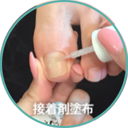 長さだしの場合はチップを使い長さを作っていきます